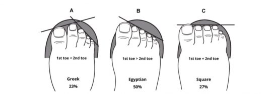 Shoe Anatomy - The Ultimate Guide to Footwear Design
